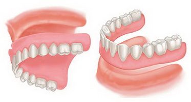 denture